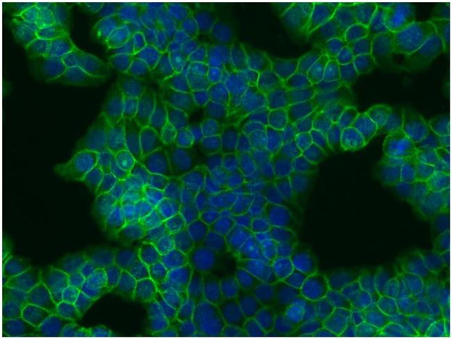 beta Catenin Antibody in Immunocytochemistry (ICC/IF)