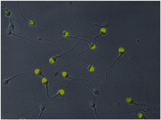 VCP Antibody in Immunocytochemistry (ICC/IF)