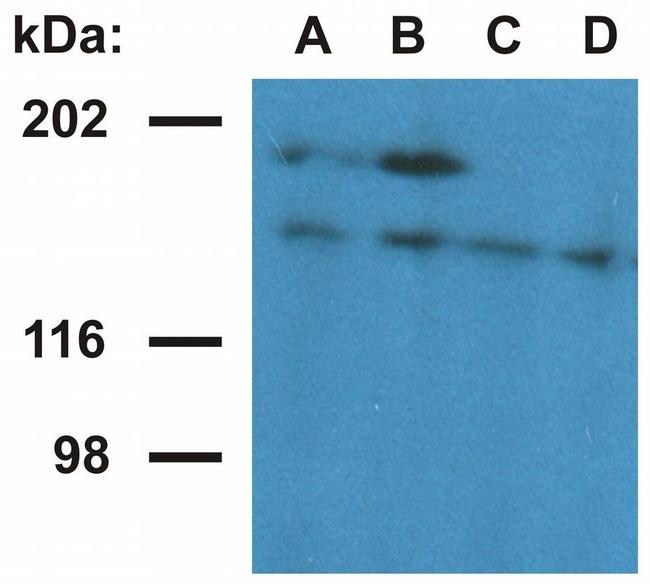 Ubinuclein 1 Antibody in Western Blot (WB)