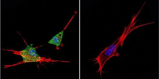 ZPR1 Antibody in Immunocytochemistry (ICC/IF)