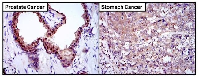 GLO1 Antibody in Immunohistochemistry (Paraffin) (IHC (P))