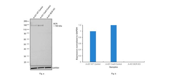 BCR-ABL Antibody in Western Blot (WB)