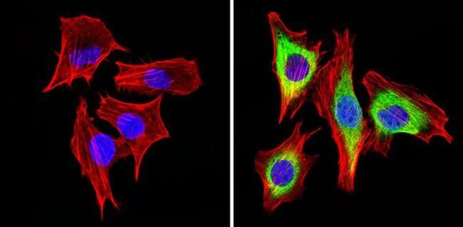 Cyclin B1 Antibody in Immunocytochemistry (ICC/IF)