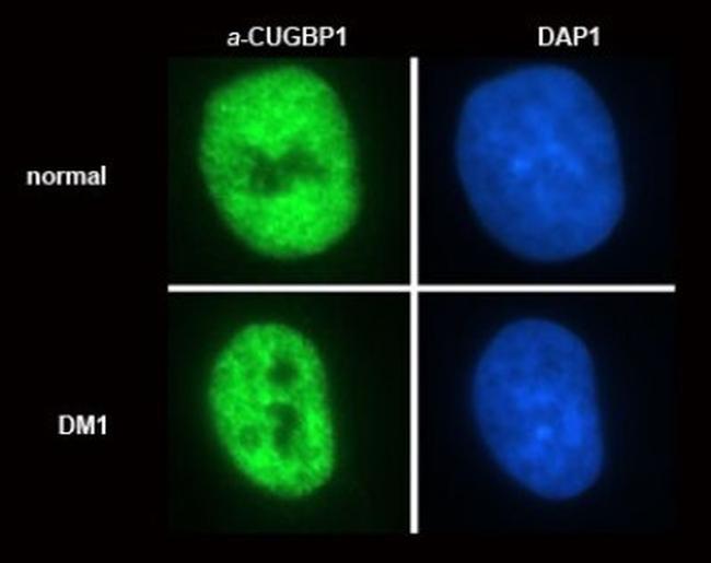 CUGBP1 Antibody in Immunocytochemistry (ICC/IF)