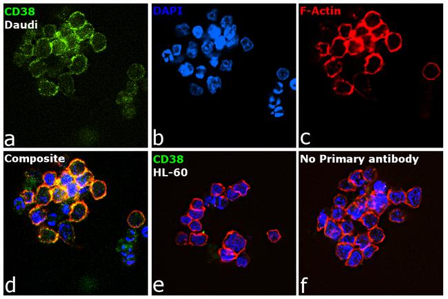 CD38 Antibody in Immunocytochemistry (ICC/IF)