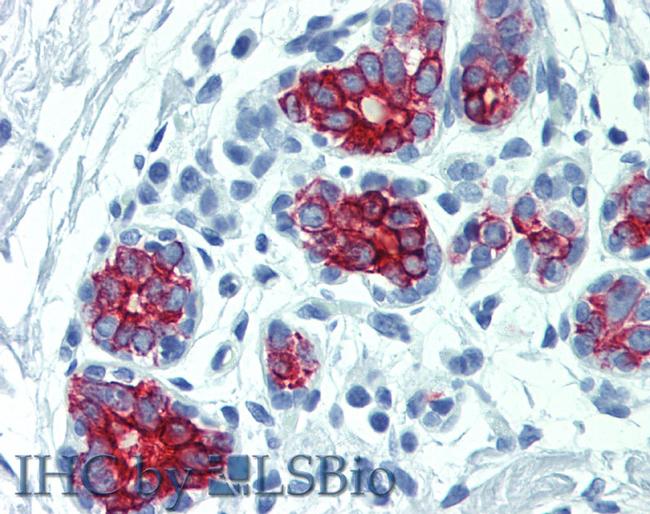 Cytokeratin 7/17 Antibody in Immunohistochemistry (Paraffin) (IHC (P))