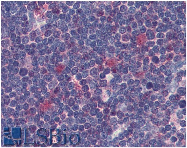 CDK1 Antibody in Immunohistochemistry (Paraffin) (IHC (P))