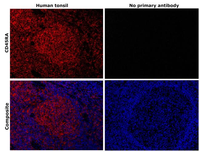 CD45RA Antibody in Immunohistochemistry (Paraffin) (IHC (P))