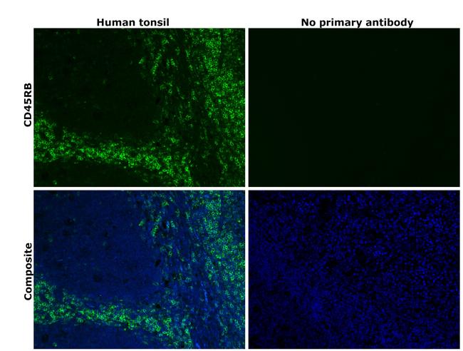 CD45RB Antibody in Immunohistochemistry (Paraffin) (IHC (P))