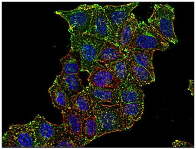 Transferrin Receptor Antibody in Immunocytochemistry (ICC/IF)