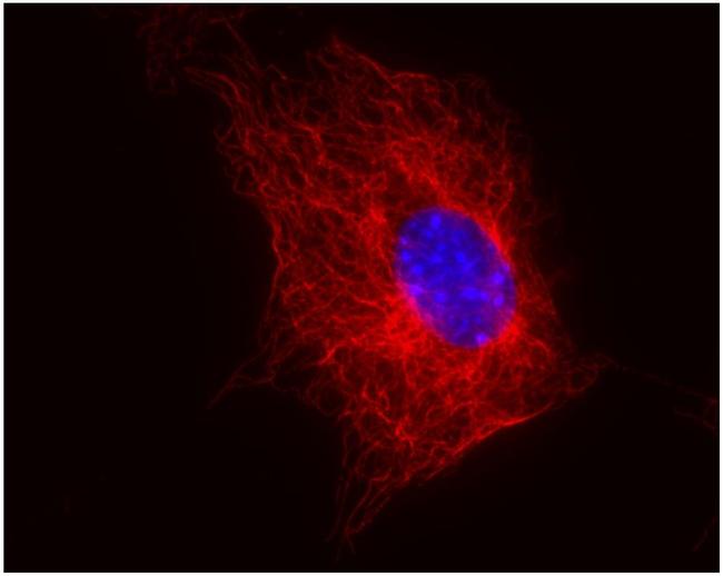 beta Tubulin Antibody in Immunocytochemistry (ICC/IF)