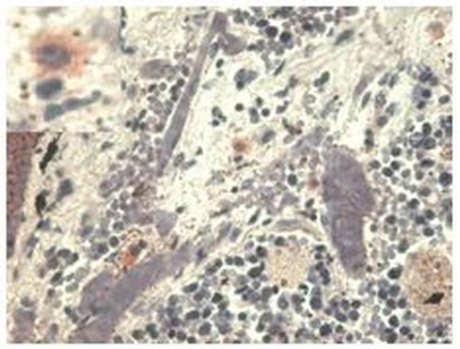 HLA-G Antibody in Immunohistochemistry (Paraffin) (IHC (P))