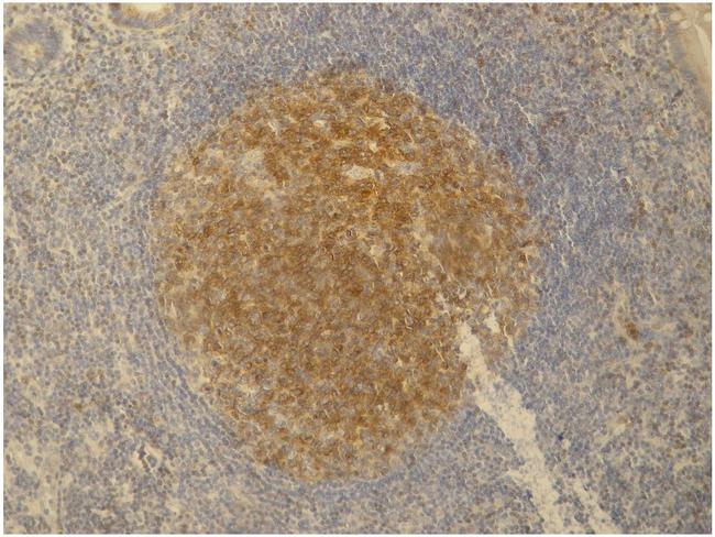 PAG1 Antibody in Immunohistochemistry (Paraffin) (IHC (P))