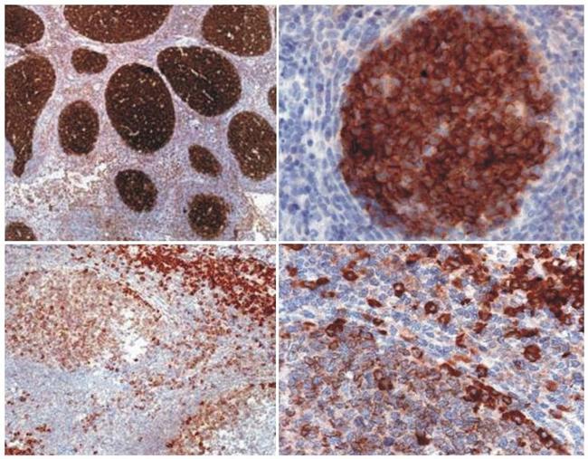 PAG1 Antibody in Immunohistochemistry (Paraffin) (IHC (P))