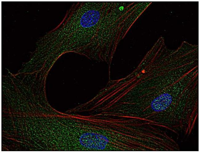 Fyn Antibody in Immunocytochemistry (ICC/IF)