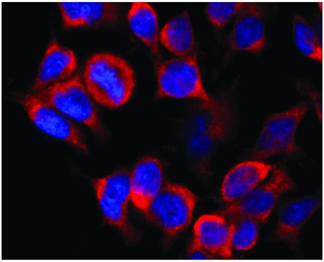 Kinesin 5B Antibody in Immunocytochemistry (ICC/IF)