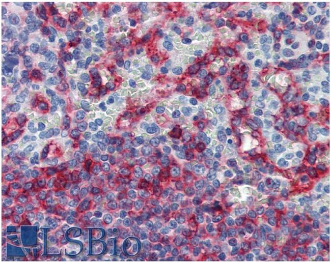 HLA-E Antibody in Immunohistochemistry (Paraffin) (IHC (P))