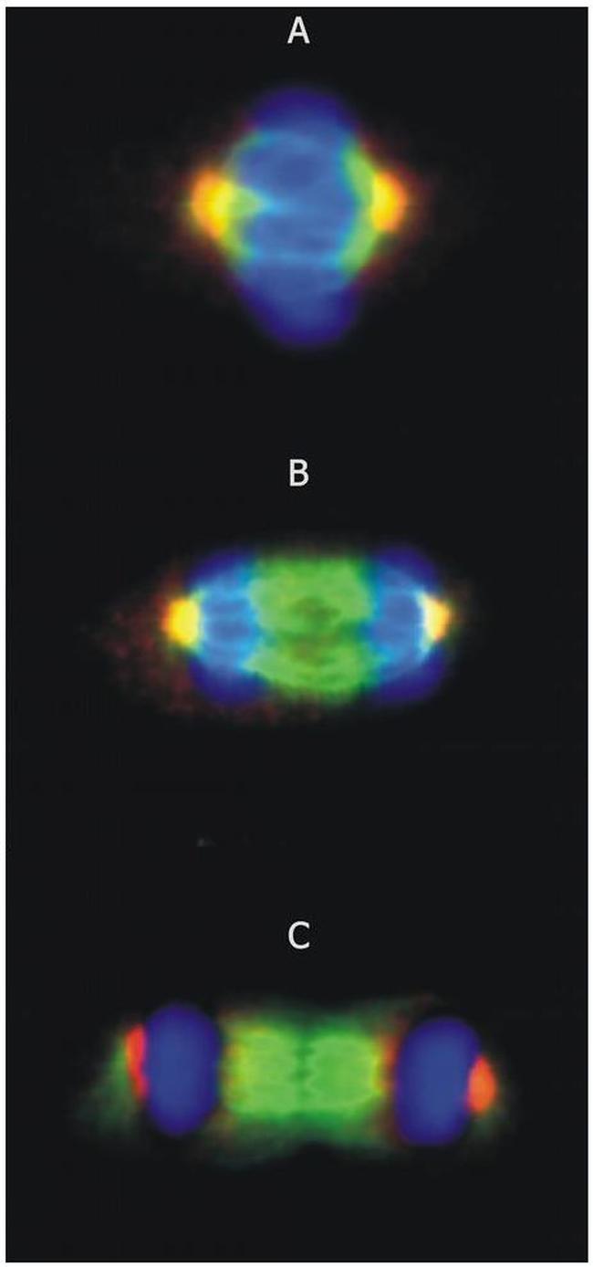 gamma Tubulin Antibody in Immunocytochemistry (ICC/IF)