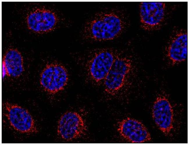 STIM1 Antibody in Immunocytochemistry (ICC/IF)