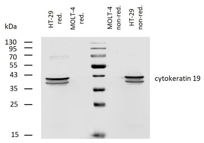 Cytokeratin 19 Antibody in Western Blot (WB)