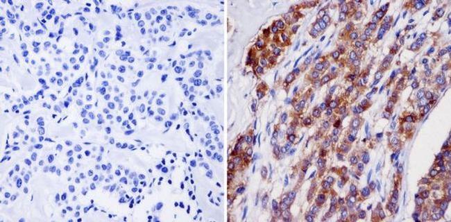 NMDAR2B Antibody in Immunohistochemistry (Paraffin) (IHC (P))