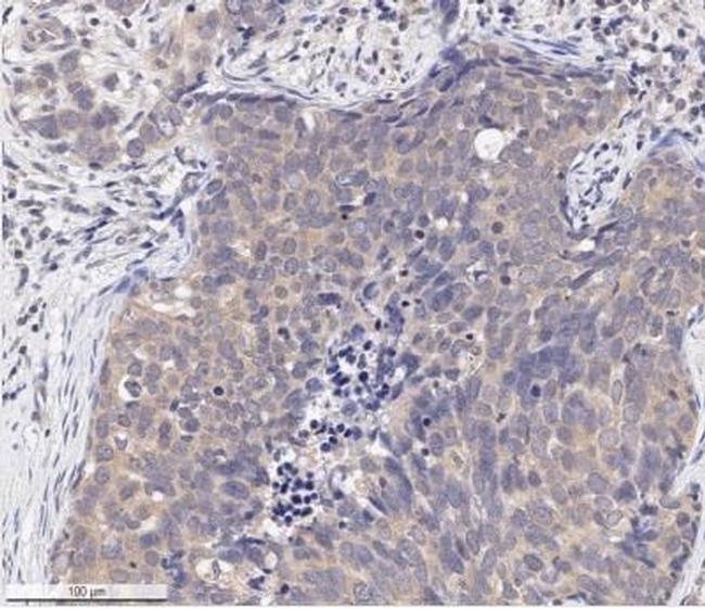 Phospho-AKT1 (Ser473) Antibody in Immunohistochemistry (Paraffin) (IHC (P))