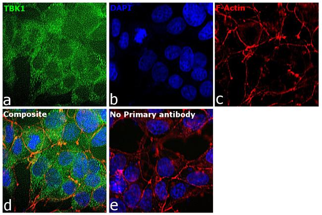 TBK1 Antibody in Immunocytochemistry (ICC/IF)