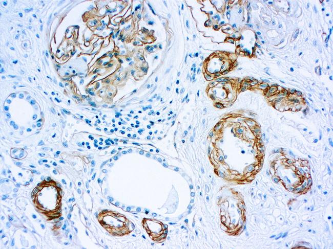 Laminin alpha-1 Antibody in Immunohistochemistry (Paraffin) (IHC (P))