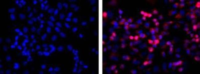 6x-His Tag Antibody in Immunocytochemistry (ICC/IF)