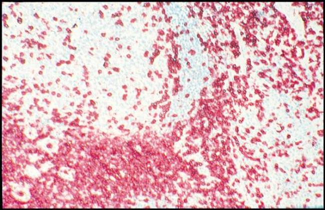 CD3e Antibody in Immunohistochemistry (Frozen) (IHC (F))