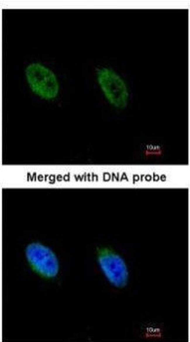 ATR Antibody in Immunocytochemistry (ICC/IF)