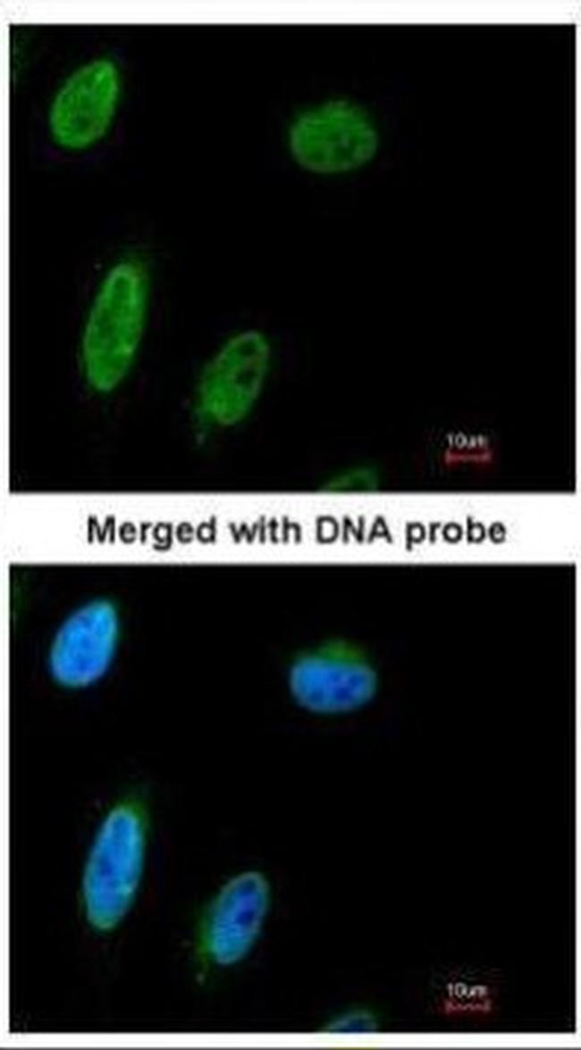 NBS1 Antibody in Immunocytochemistry (ICC/IF)