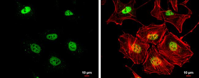 RAD50 Antibody in Immunocytochemistry (ICC/IF)