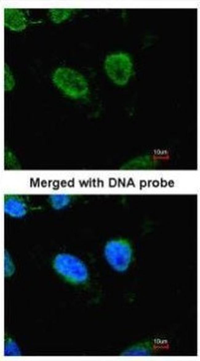 RbAp48 Antibody in Immunocytochemistry (ICC/IF)