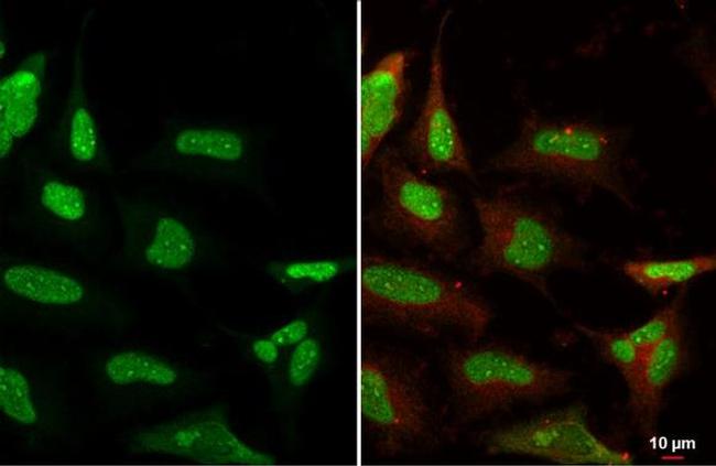 Ku80 Antibody in Immunocytochemistry (ICC/IF)