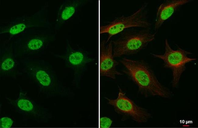 FANCD2 Antibody in Immunocytochemistry (ICC/IF)