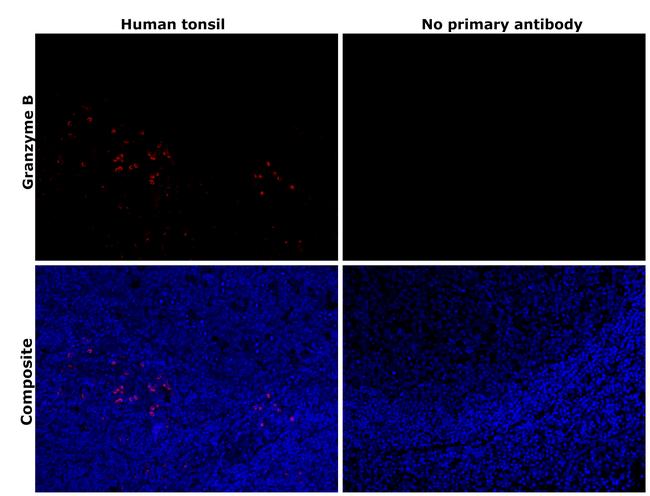 Granzyme B Antibody in Immunohistochemistry (Paraffin) (IHC (P))