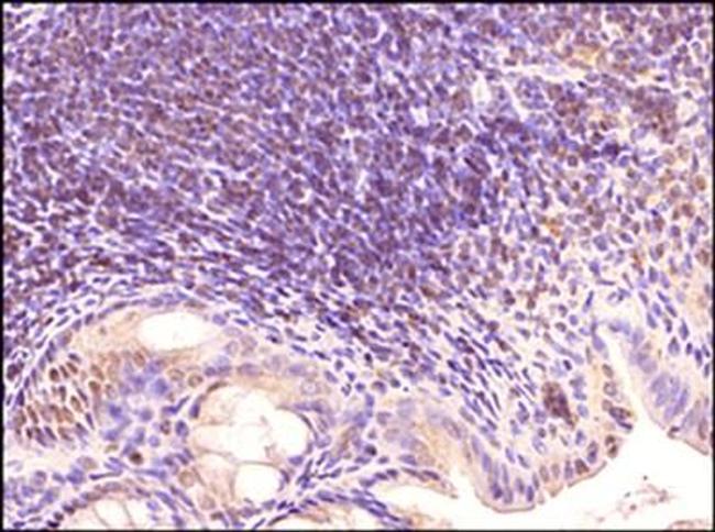 TLR3 Antibody in Immunohistochemistry (Paraffin) (IHC (P))