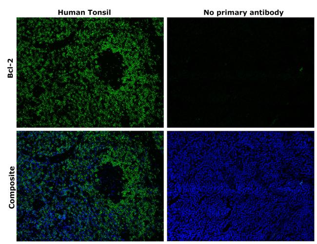 Bcl-2 Antibody in Immunohistochemistry (Paraffin) (IHC (P))