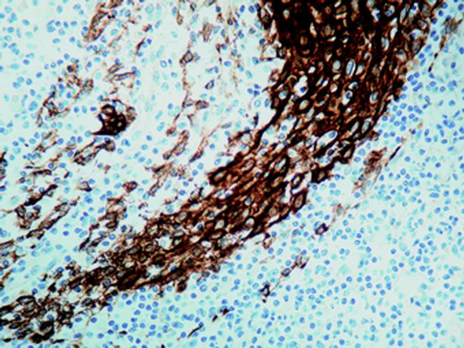 Cytokeratin Pan Type I Antibody in Immunohistochemistry (Paraffin) (IHC (P))