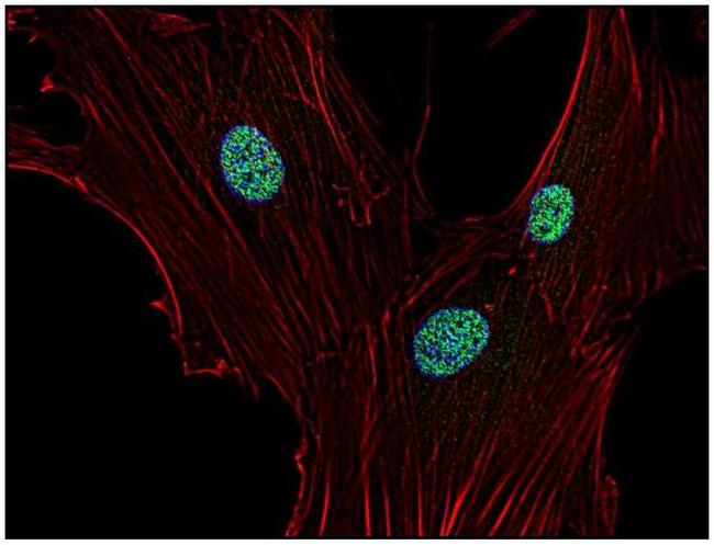 p21 Antibody in Immunocytochemistry (ICC/IF)