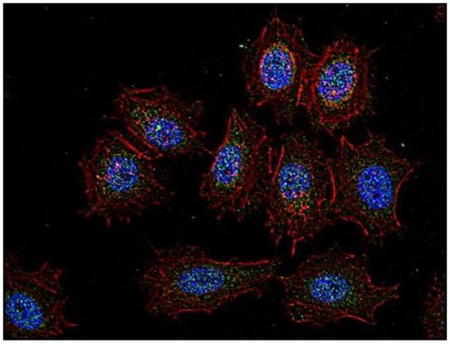 CSK Antibody in Immunocytochemistry (ICC/IF)