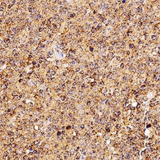 CD254 (RANK Ligand) Antibody in Immunohistochemistry (Paraffin) (IHC (P))