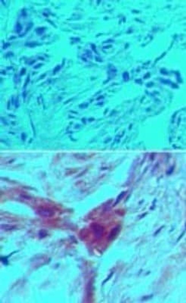 D4-GDI Antibody in Immunohistochemistry (Paraffin) (IHC (P))