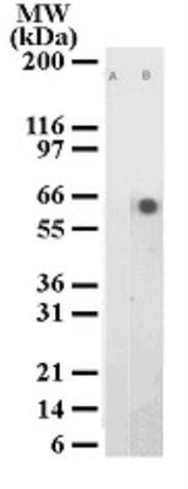 Phospho-ATF2 (Thr71) Antibody in Western Blot (WB)