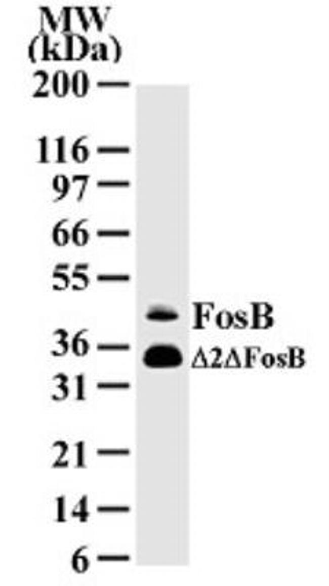 FosB Antibody in Western Blot (WB)