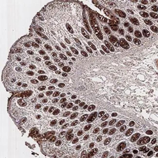 PMS2 Antibody in Immunohistochemistry (Paraffin) (IHC (P))