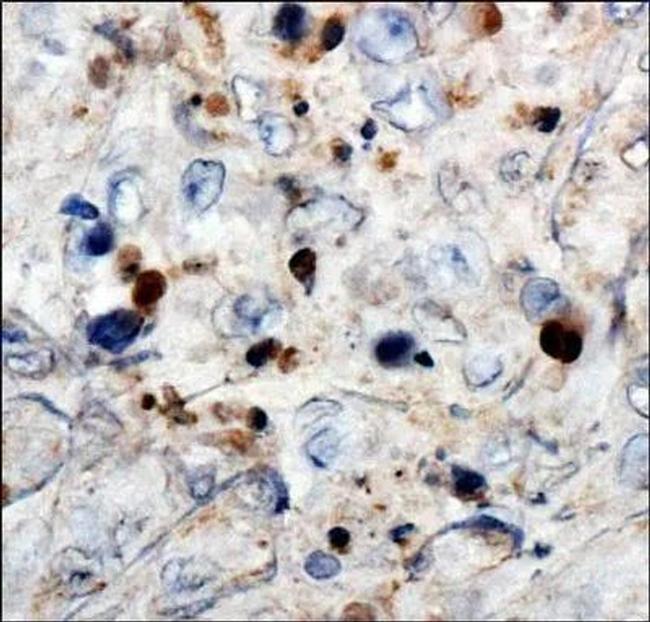 WT1 Antibody in Immunohistochemistry (Paraffin) (IHC (P))