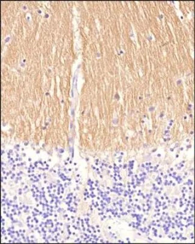 CD171 Antibody in Immunohistochemistry (Paraffin) (IHC (P))