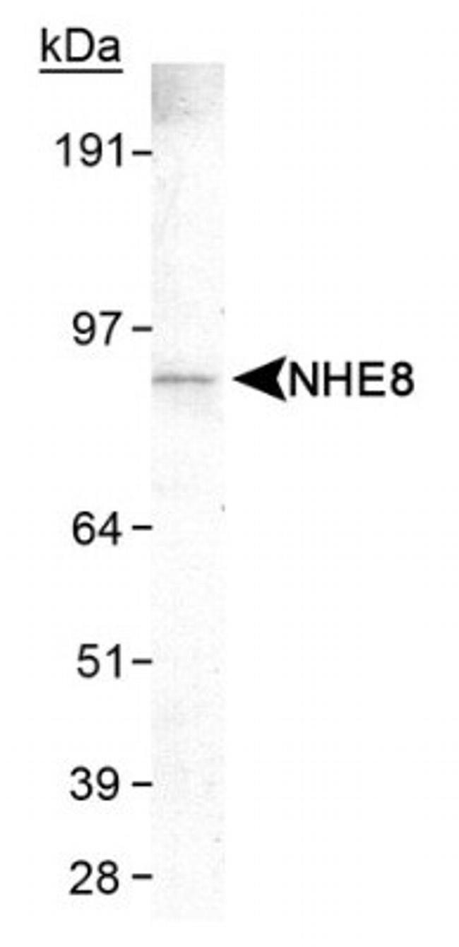 SLC9A8 Antibody in Western Blot (WB)